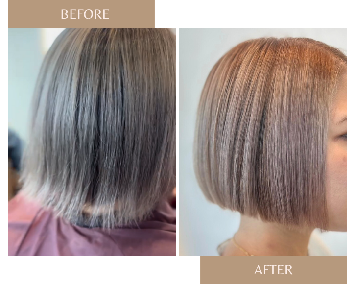 KTトリートメント 施術事例2